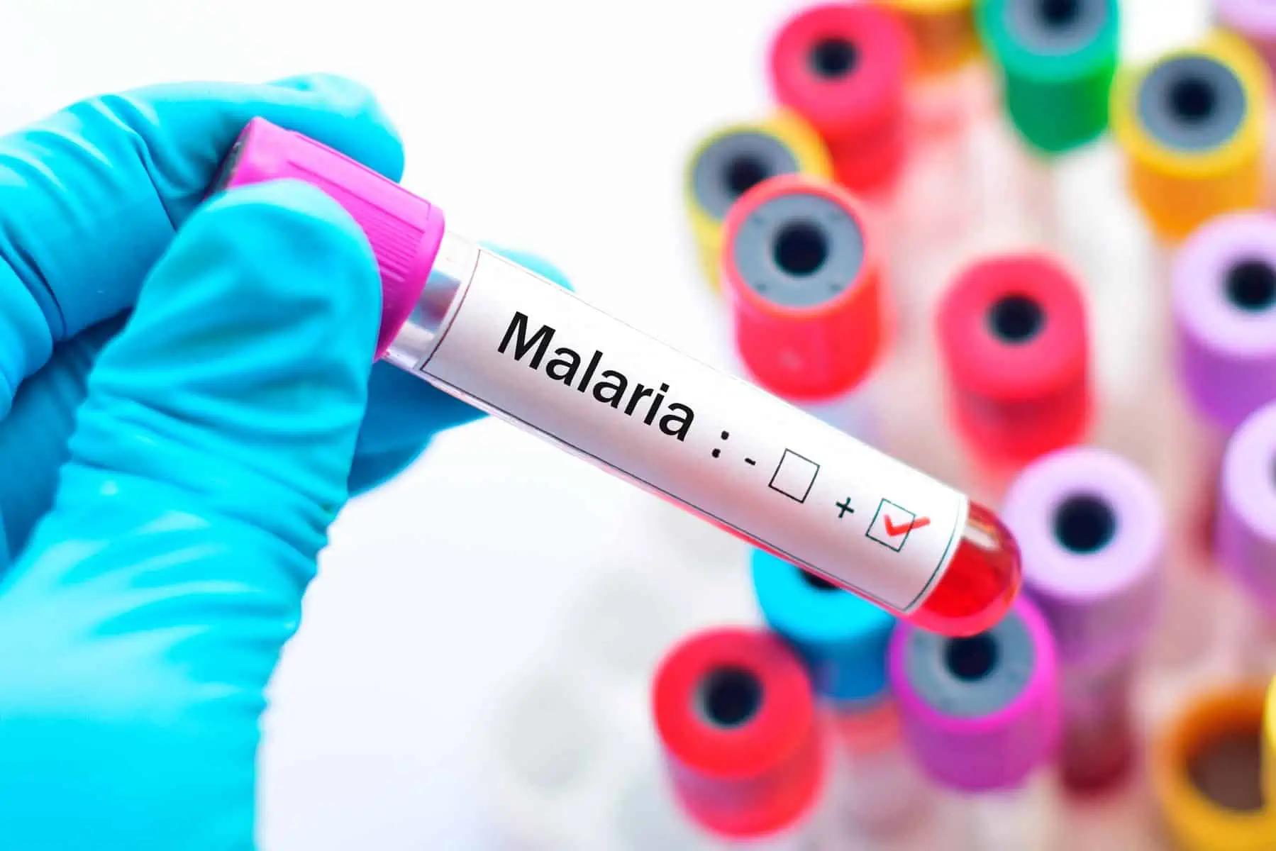CDC Emite Avisos de Salud por Casos Locales de Malaria Detectados en Estados Unidos