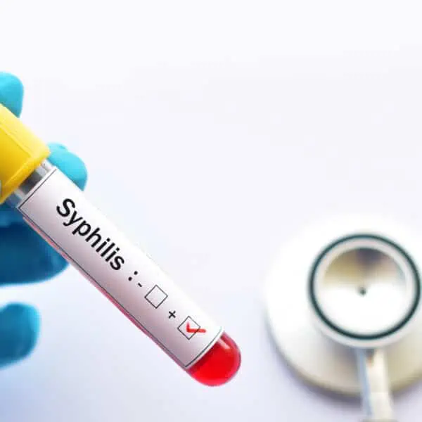 autoridades sanitarias advierten sobre brote de sifilis en houston